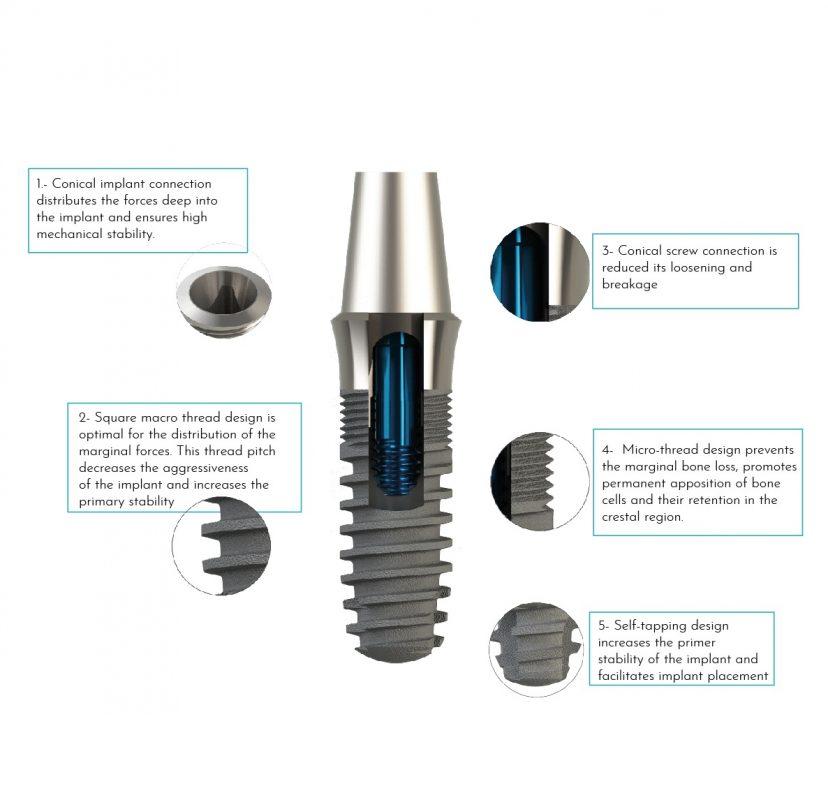 bone level implant